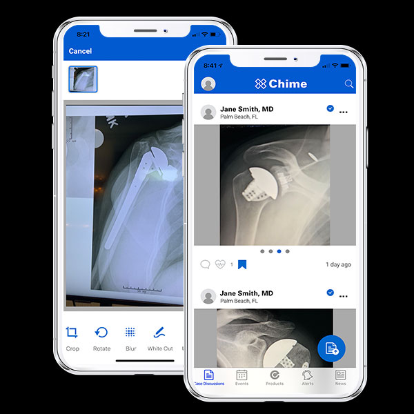 Exactech Chime App for surgeon clinical exchange and case discussions
