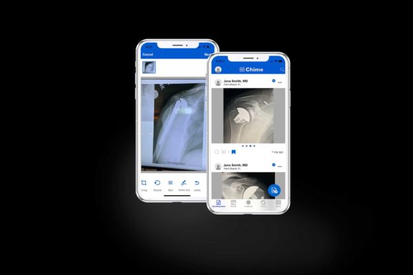 Exactech Chime Mobile Application for Surgeon Communication