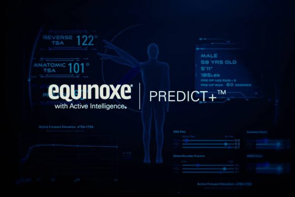 Exactech Equinoxe with Active Intelligence Predict+