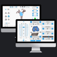 Exactech GPS Surgical Reports