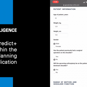 Exactech How to Access Predict+ demo Video